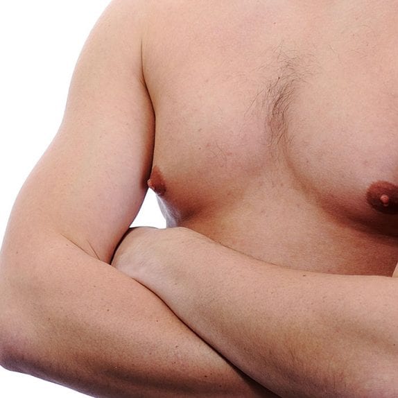 Gynaecomastia – Male Breasts – Man Boobs