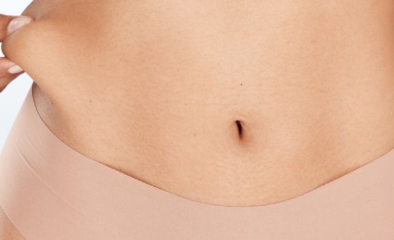 Mini Tummy Tuck