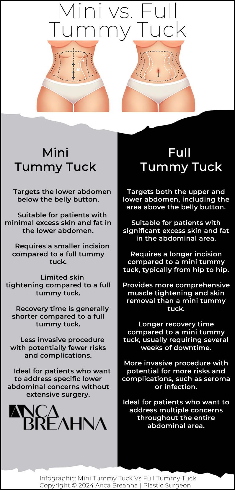 Infographics Mini vs Full Tummy Tuck