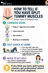 Split Tummy Muscles - Causes and Solutions Infographics - Anca Breahna