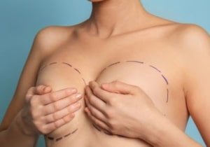 Causes and Treatments for Tuberous Breasts