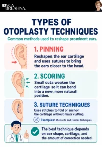 How to Fix Ears that Protrude – Overly Prominent Ears Infographics - Anca Breahna