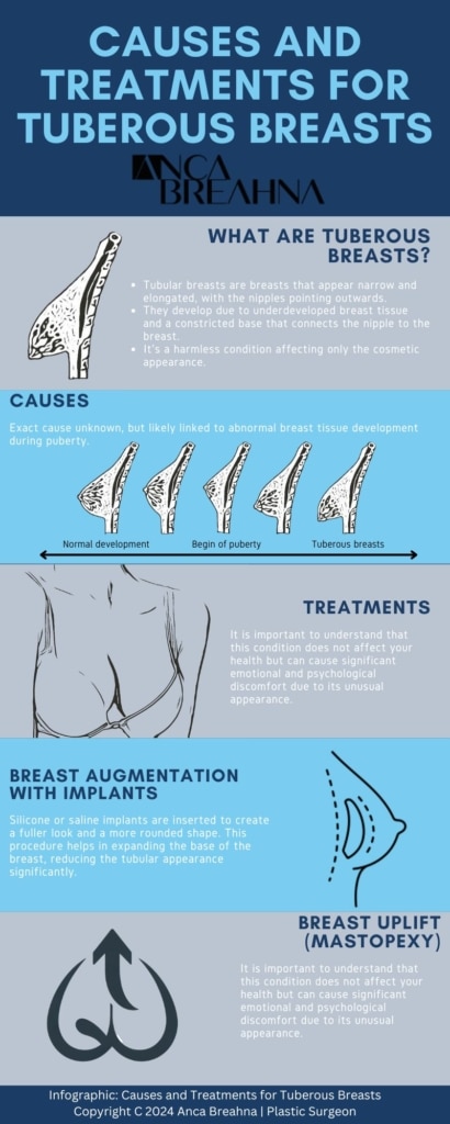 Causes and treatments for tuberous breasts infographics
