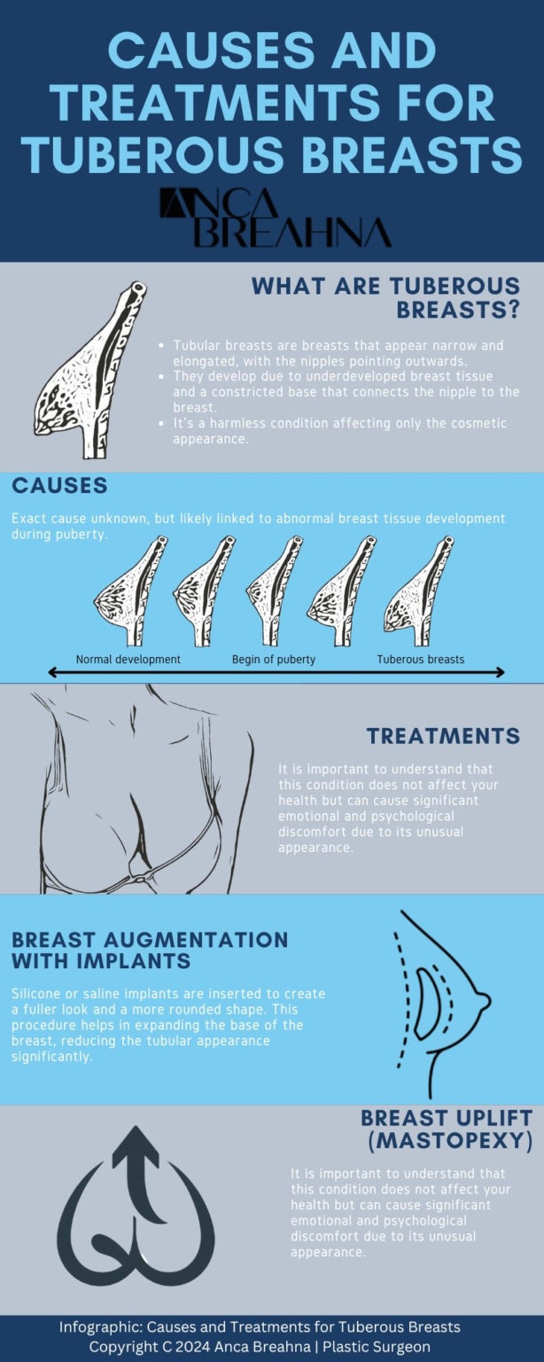 Is It Normal For Breasts To Be Different Shapes