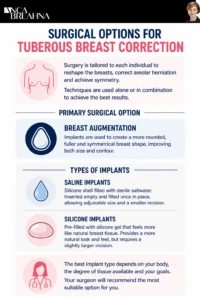 What are Tuberous Breasts and How to Correct Them Infographics 2 - Anca Breahna
