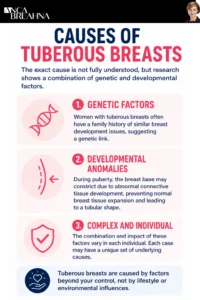 What are Tuberous Breasts and How to Correct Them Infographics - Anca Breahna