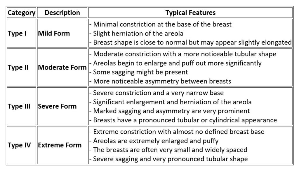 Tuberous breasts classification