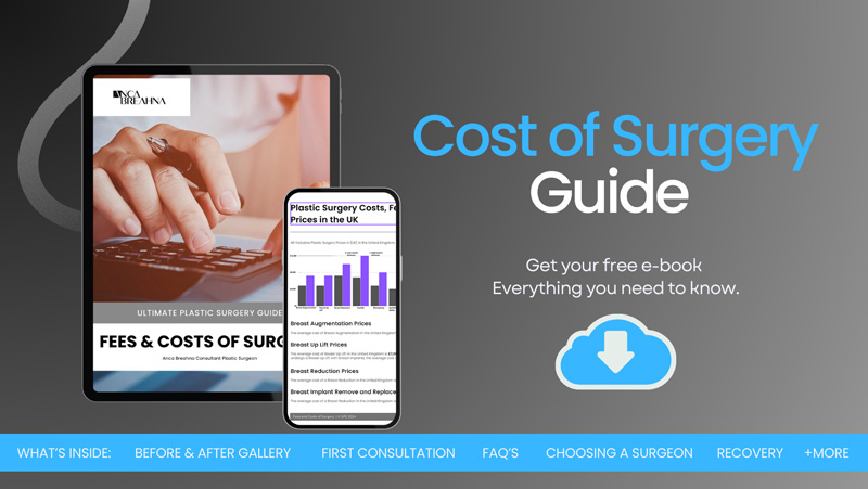 Cost of Surgery Guide