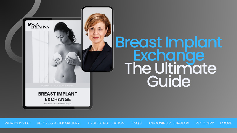 Breast Implant Explant Guide