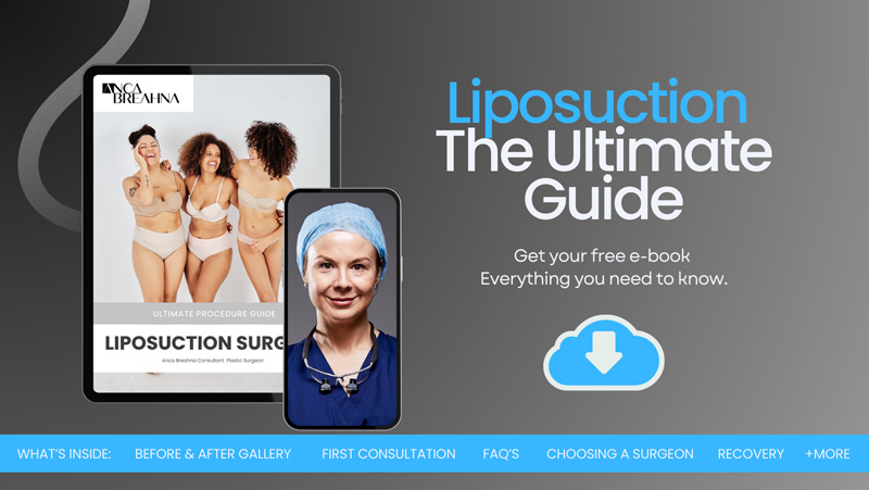 Liposuction Guide