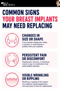 Signs It’s Time to Replace Your Breast Implants Infographics - Anca Breahna