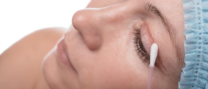 Treatment for Blepharoplasty scars