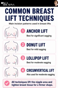 Do I need a Breast Lift or Implants Infographics - Anca Breahna