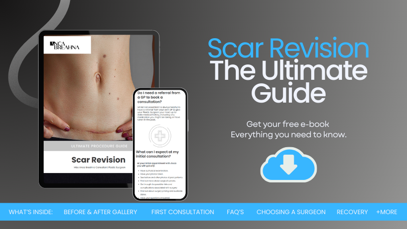 Scar Revision Guide