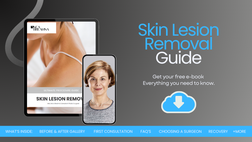 Skin Lesion Guide