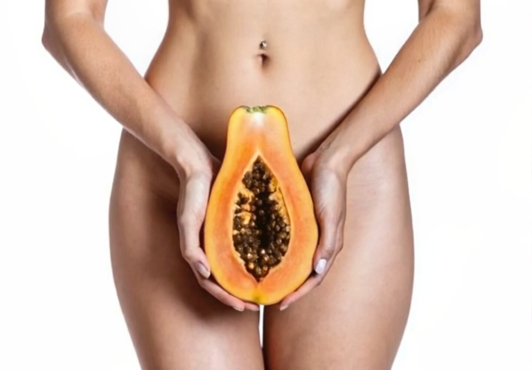 Stretch Labia - Image Ancabreahna