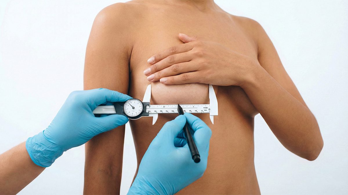 How To Get A Natural Looking Breast Augmentation Using Smaller Implants by Dr Anca Breahna