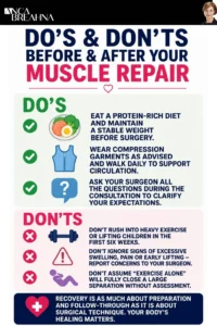 Surgery for Diastasis Recti – Muscle Repair Explained Infographics - Anca Breahna