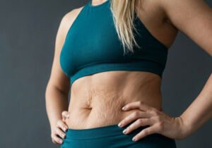 Drains vs Drainless Tummy Tuck: Pros, Cons and Recovery Differences