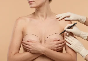 Do I Need a Breast Uplift or Can Implants Alone Fix Sagging?