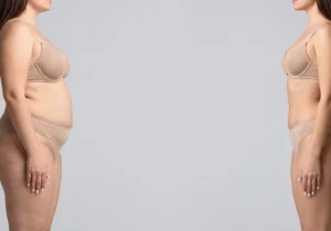 What Is Included In A Mummy Makeover And Is It Done In One Surgery?