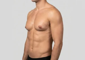 Why Do Slim Men Get Gynaecomastia And What Are The Options?
